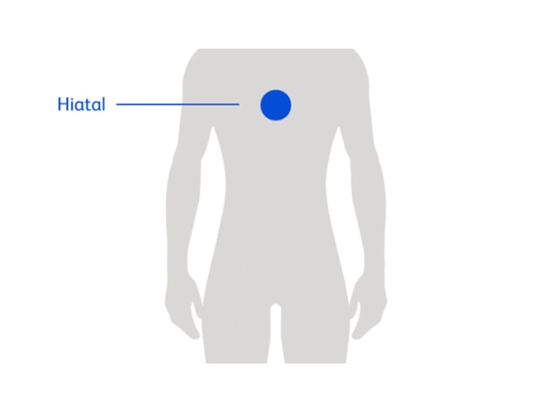 hernia-types-hiatal-graphic.png