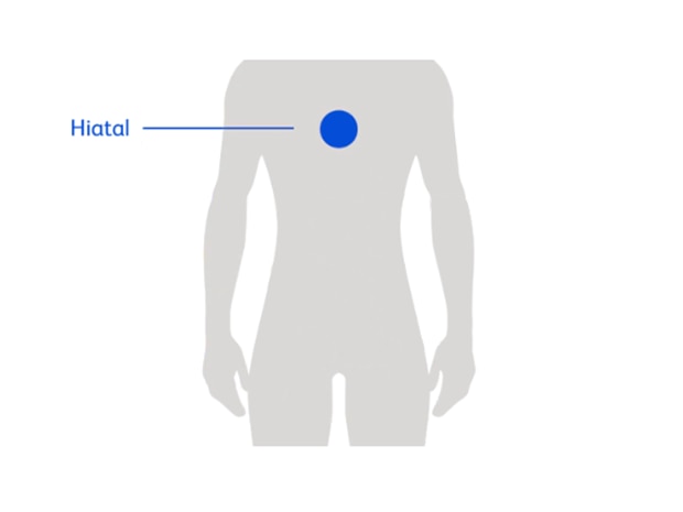Ventral Hernia